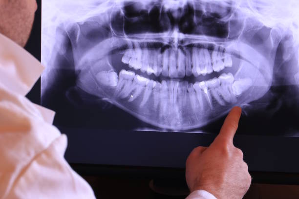 Best Emergency Treatment for Dental Infections or Abscesses in Lonaconing, MD