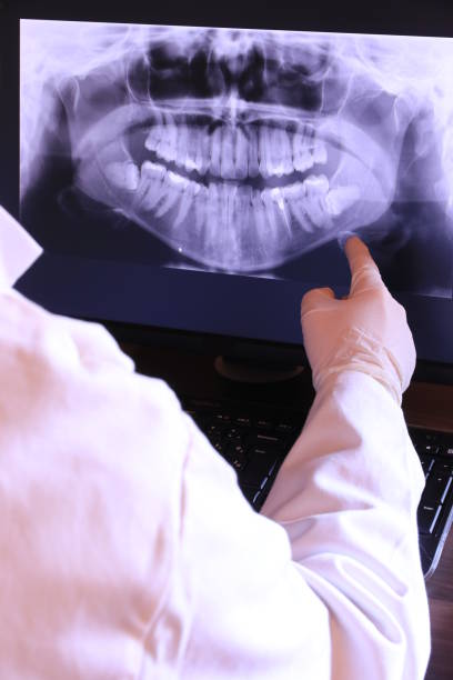 Best Emergency Dental Care for Broken or Chipped Teeth in Lonaconing, MD